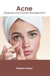 Acne: Diagnosis and Clinical Management