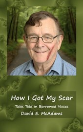 How I Got My Scar