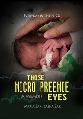 Those Micro Preemie Eyes