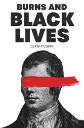 Burns and Black Lives