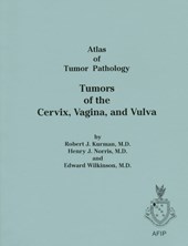 Tumors of the Salivary Glands