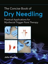 The Concise Book of Dry Needling