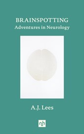 Brainspotting