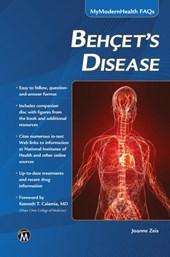 Behcet’s Disease