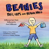 Beanies, Ball Caps, and Being Bald