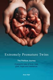 Extremely Premature Twins