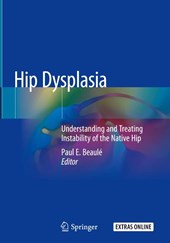 Hip Dysplasia