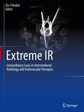 Extreme IR