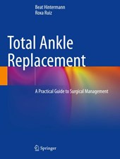 Total Ankle Replacement