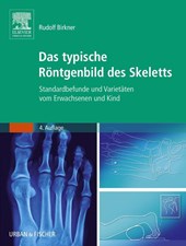 Das typische Röntgenbild des Skeletts