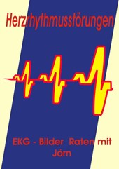 Herzrhythmusstoerungen