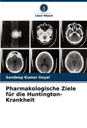 Pharmakologische Ziele für die Huntington-Krankheit