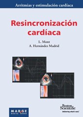 Resincronización cardíaca