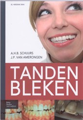 Tanden bleken