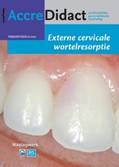 Externe cervicale wortelresorptie