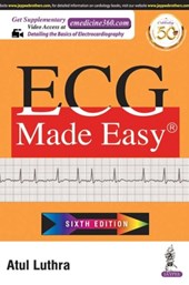 ECG Made Easy