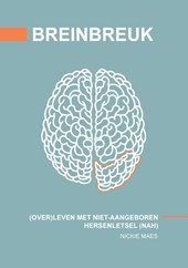 Breinbreuk