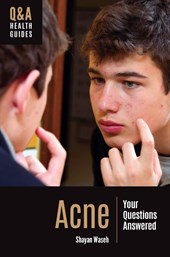 Acne