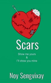 Scars