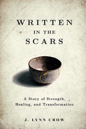 Written in the Scars