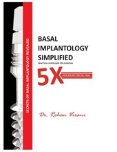 Basal Implantology Simplified: 5x YOUR IMPLANT PRACTISE