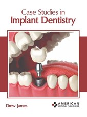 Case Studies in Implant Dentistry