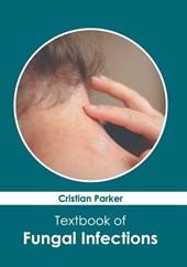 Textbook of Fungal Infections