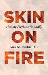 Skin on Fire