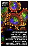 Observations on the Causes, Symptoms, and Nature of Scrofula or King's Evil, Scurvy, and Cancer - John Kent - 8596547345282