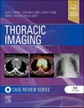 Thoracic Imaging: Case Review - Justin T. Stowell ; Jonathan H. (Section Chief Chung ; Jeffrey P. (Professor and Chief of Thoracic Imaging Kanne ; Theresa C. (Associate Radiologist-in-Chief McLoud - 9780323428798