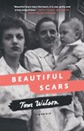 Beautiful Scars - Tom Wilson - 9780385685665