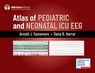 Atlas of Pediatric and Neonatal ICU EEG - Arnold J. Sansevere ; Dana B. Harrar - 9780826148667