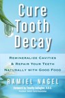 Cure Tooth Decay - Ramiel Nagel ; D D S Timothy Gallagher - 9780982021323