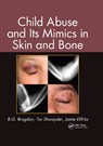 Child Abuse and its Mimics in Skin and Bone - B. G. Brogdon ; Tor Shwayder ; Jamie Elifritz - 9781439855355