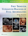First Trimester Ultrasound Diagnosis of Fetal Abnormalities - Alfred Z. Abuhamad ; Rabih Chaoui - 9781451193725