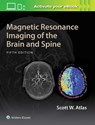 Magnetic Resonance Imaging of the Brain and Spine - Scott W. Atlas - 9781469873206
