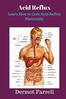 Acid Reflux: Learn How to Cure Acid Reflux Naturally - Dermot Farrell - 9781546367499