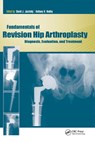 Fundamentals of Revision Hip Arthroplasty - David Jacofsky ; Anthony Hedley - 9781556429521