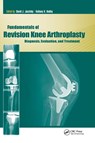 Fundamentals of Revision Knee Arthroplasty - David Jacofsky ; Anthony Hedley - 9781556429743