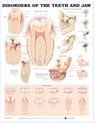 Disorders of the Teeth and Jaw Anatomical Chart -  - 9781587792496