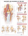 Anatomy and Injuries of the Hip Anatomical Chart -  - 9781587793820