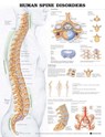 Human Spine Disorders Anatomical Chart -  - 9781587794438