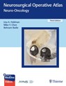 Neurosurgical Operative Atlas: Neuro-Oncology - Lisa Feldman ; Mike Y. Chen ; Behnam Badie - 9781626231085