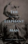 Reminiscences of The Elephant Man - Frederick Treves ; Others - 9781735320113