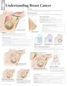 Understanding Breast Cancer Paper Poster -  - 9781935612308