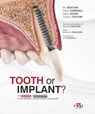 Tooth or Implant - Paolo Generali ; Fabio Gorni ; Tiziano Testori - 9781957260525