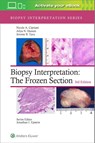 Biopsy Interpretation: The Frozen Section: Print + eBook with Multimedia - Nicole A. Cipriani ; Aliya N. Husain ; Jerome B. Taxy - 9781975170073