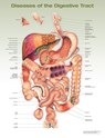 Diseases of the Digestive Tract Anatomical Chart -  - 9781975243258
