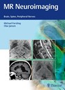 MR Neuroimaging - Michael Forsting ; Olav Jansen - 9783132026810
