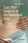 Scars After Surgeries in the Abdominal Area - Michaela Liedler - 9783662713761
